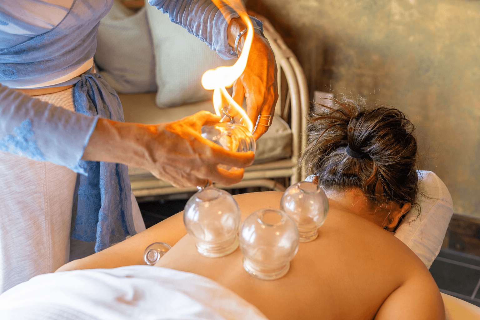 A therapist applies glass cups for cupping therapy on a client's back.